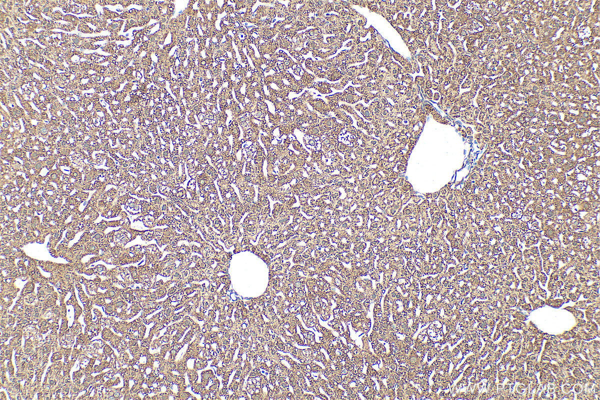 IHC staining of mouse liver using 31793-1-AP