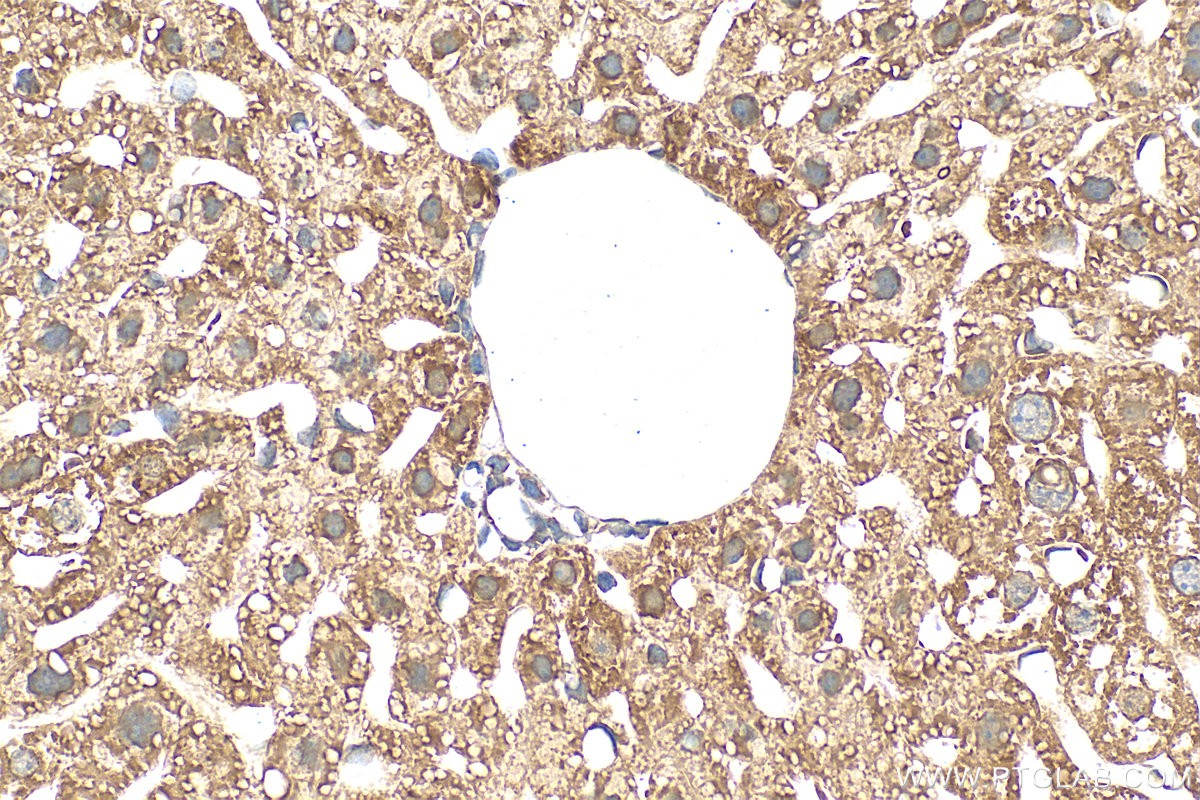 IHC staining of mouse liver using 31793-1-AP