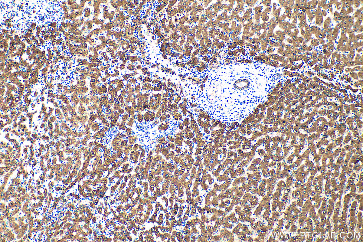 IHC staining of human liver using 31793-1-AP