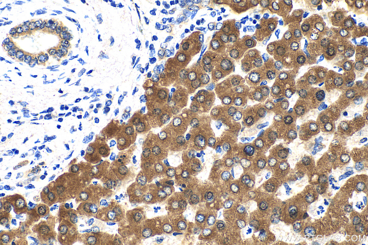 IHC staining of human liver using 31793-1-AP