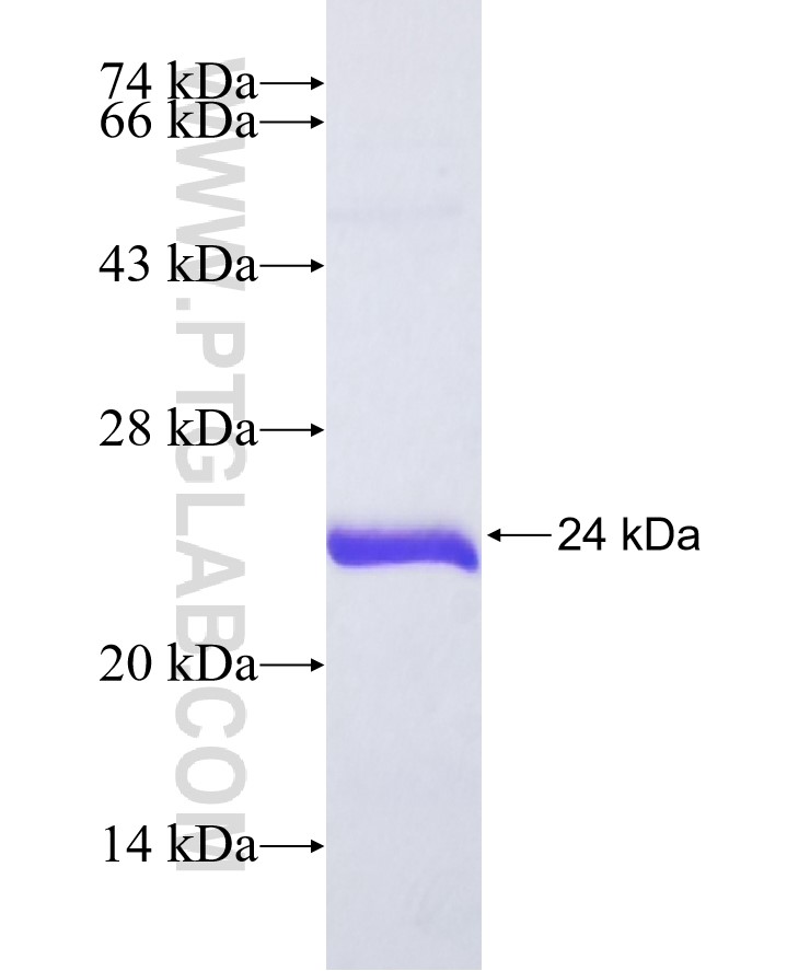 PON3 fusion protein Ag36624 SDS-PAGE PON3 fusion protein Ag36624 SDS-PAGE