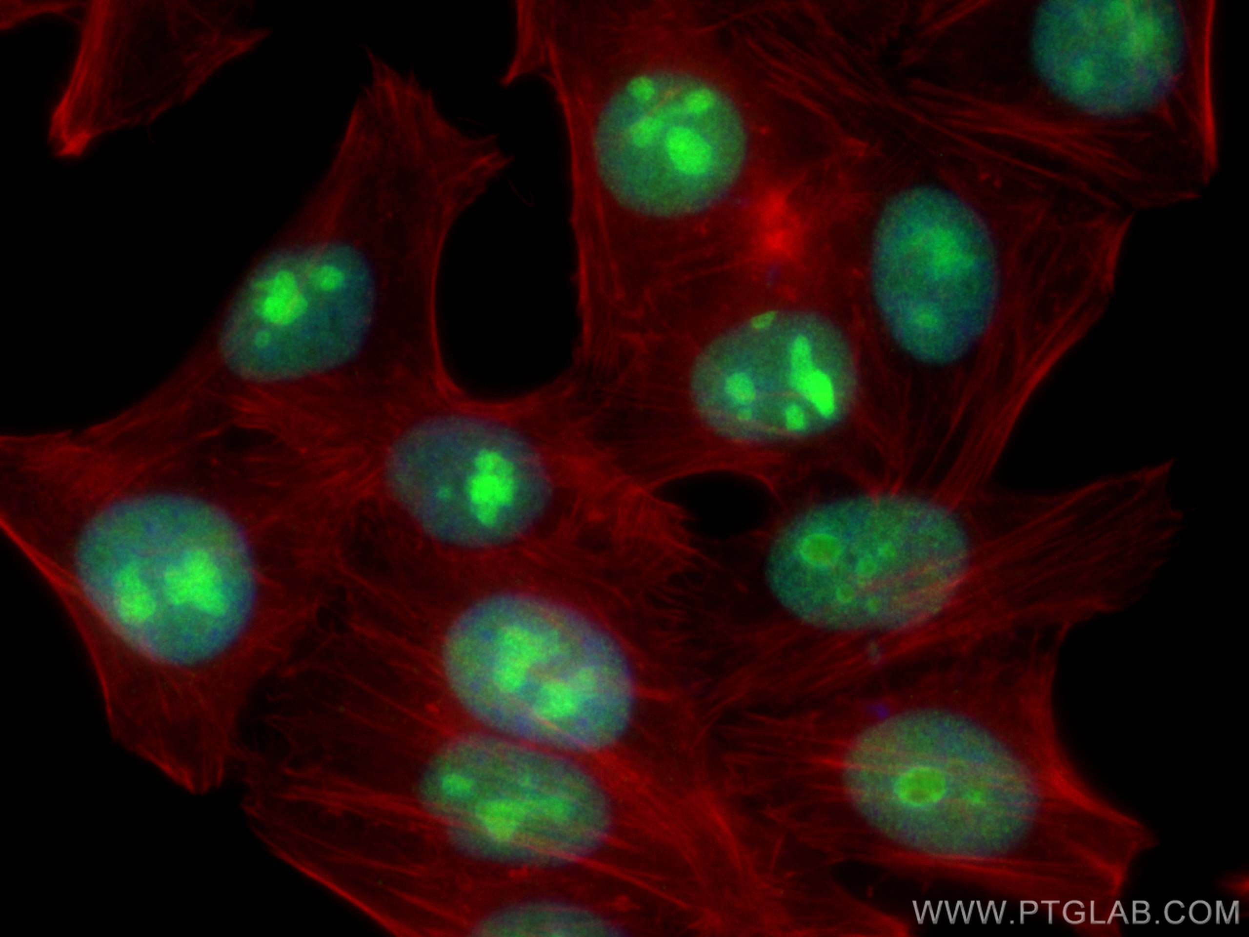 IF Staining of HepG2 using 12029-1-AP