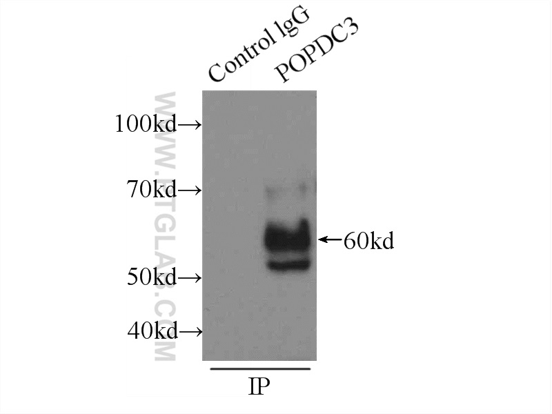 IP experiment of HeLa using 11800-1-AP