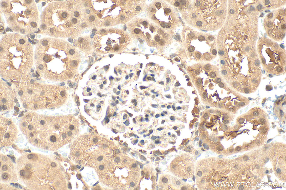 IHC staining of rat kidney using 20613-1-AP