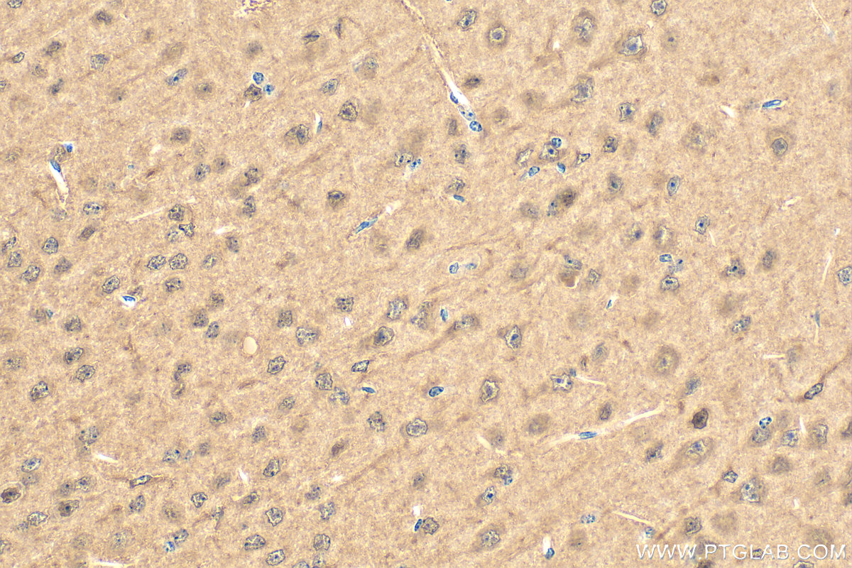 IHC staining of mouse brain using 20613-1-AP
