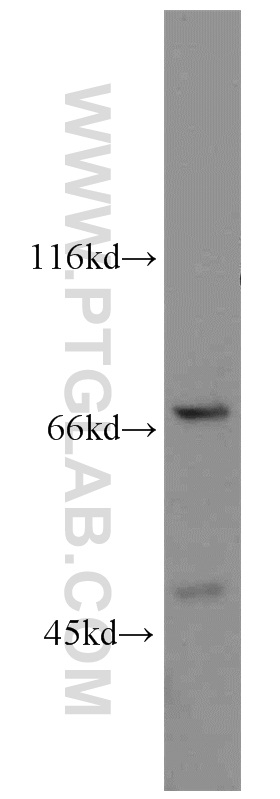 WB analysis of HeLa using 10581-1-AP