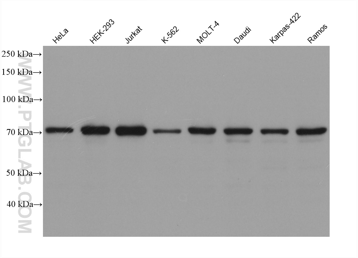 Various lysates were subjected to SDS PAGE followed by western blot with 60556-7-Ig (POT1 antibody) at dilution of 1:10000 incubated at room temperature for 1.5 hours. WB analysis using 60556-7-Ig