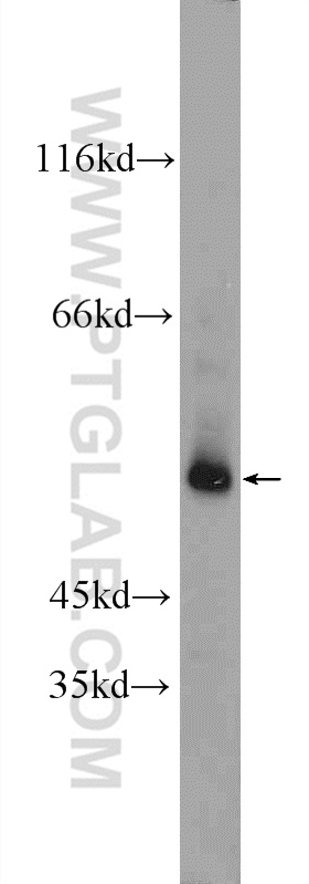 WB analysis of human testis using 24593-1-AP