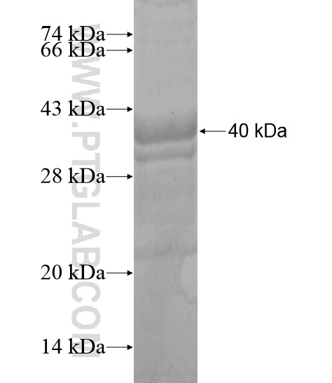 POTEA fusion protein Ag20188 SDS-PAGE POTEA fusion protein Ag20188 SDS-PAGE