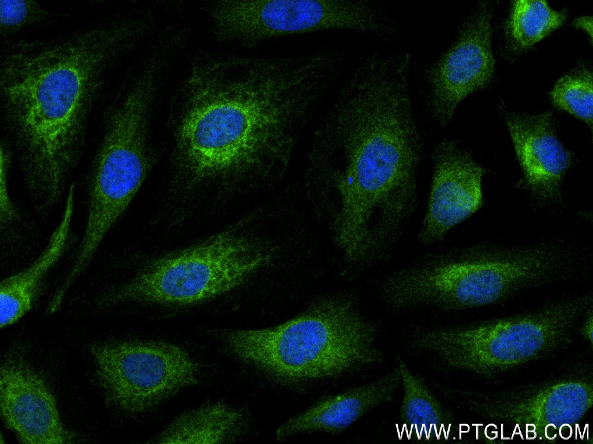 IF Staining of HepG2 using 84298-1-RR (same clone as 84298-1-PBS)