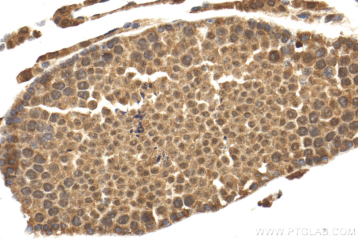 IHC staining of mouse testis using 20205-1-AP