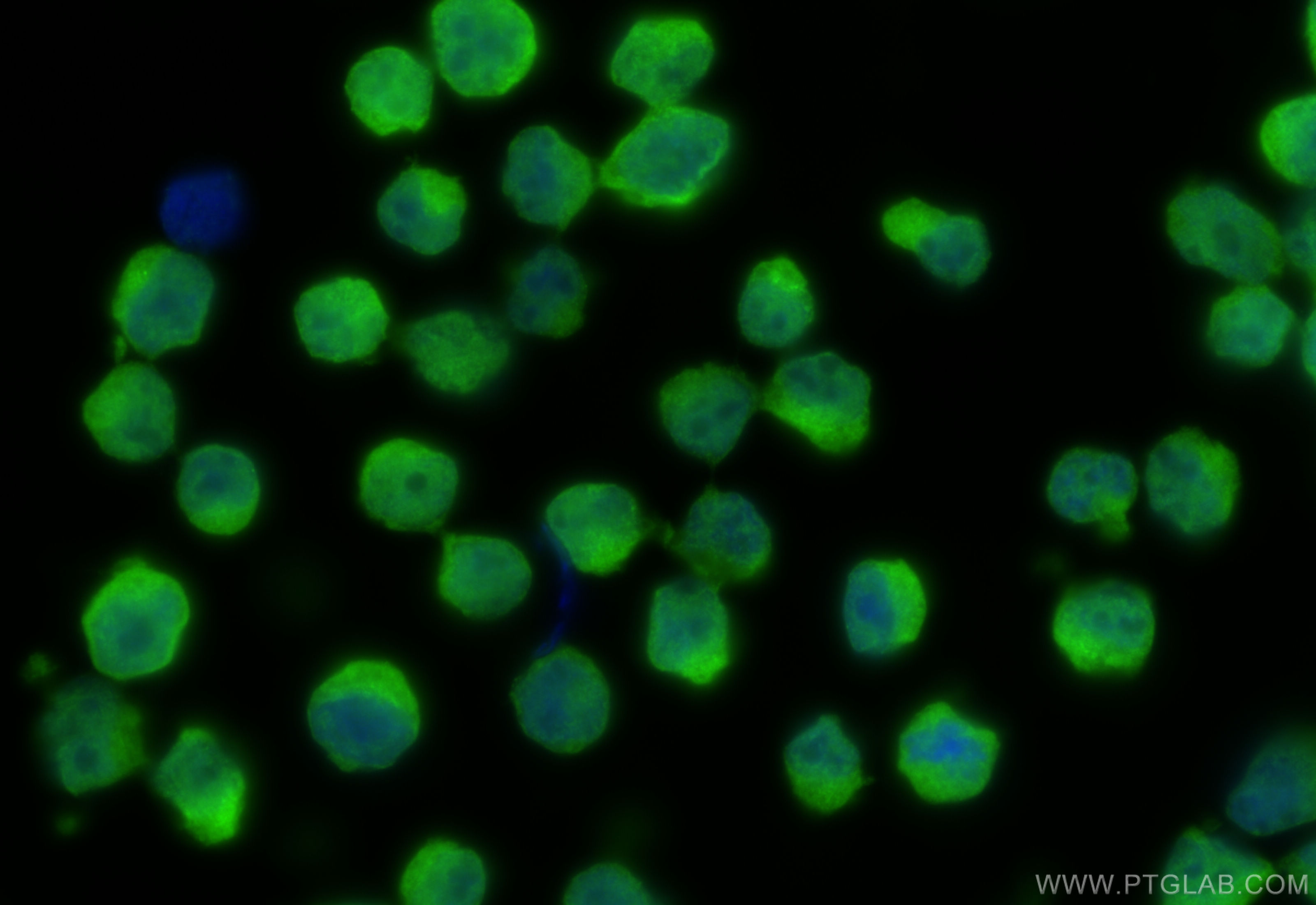 IF Staining of Raji using 13605-1-AP