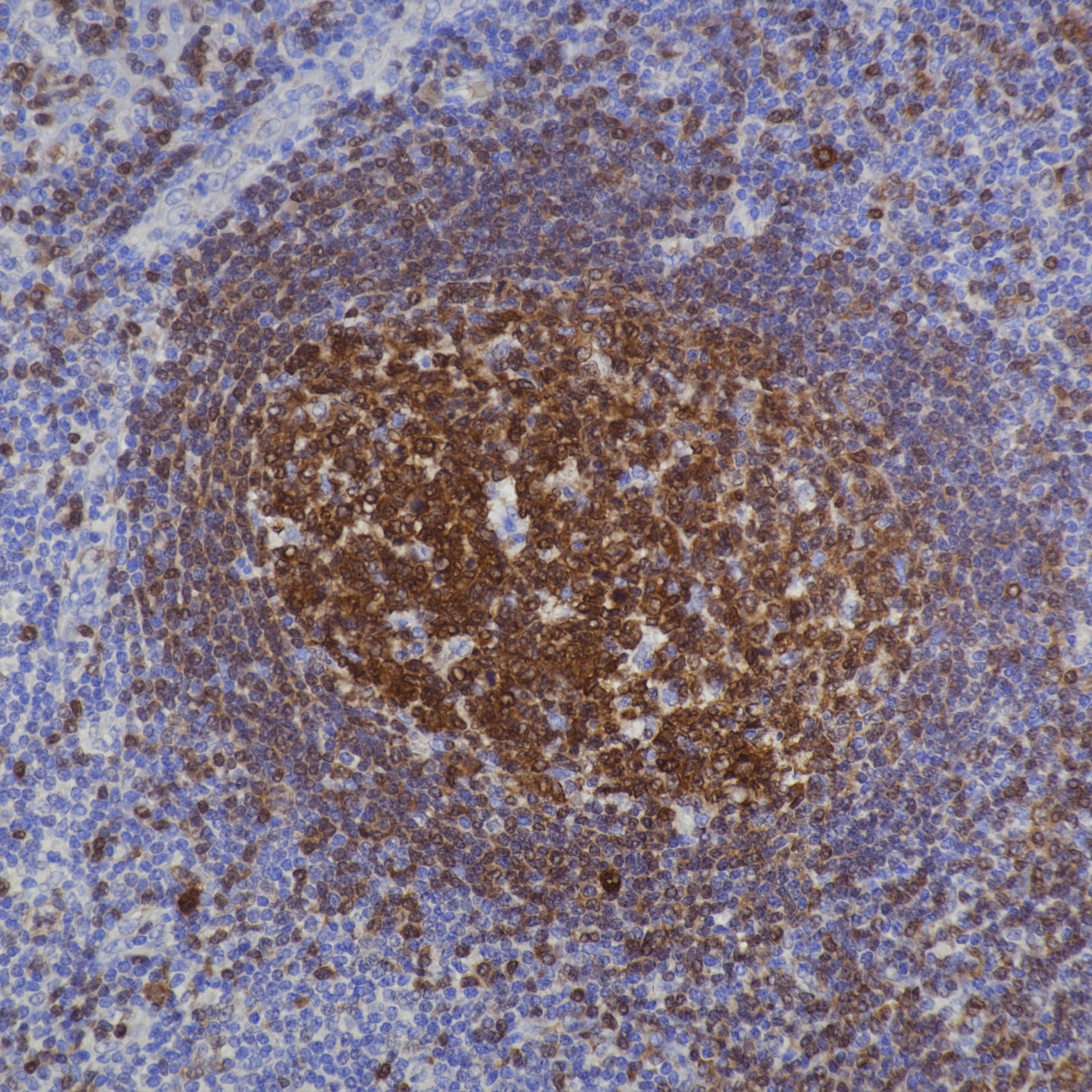 IHC staining of human tonsil using 66659-1-Ig IHC staining of human tonsil using 66659-1-Ig