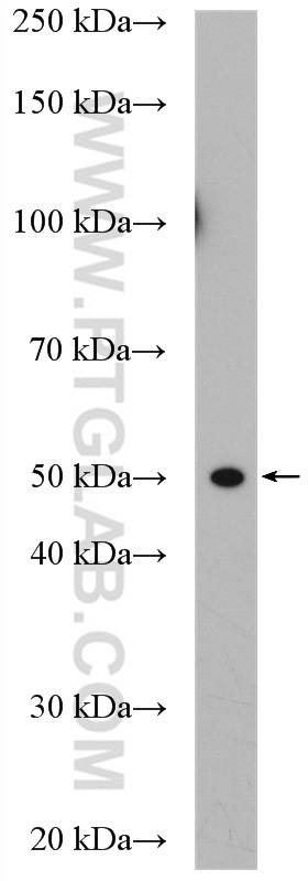 WB analysis of HeLa using 14596-1-AP