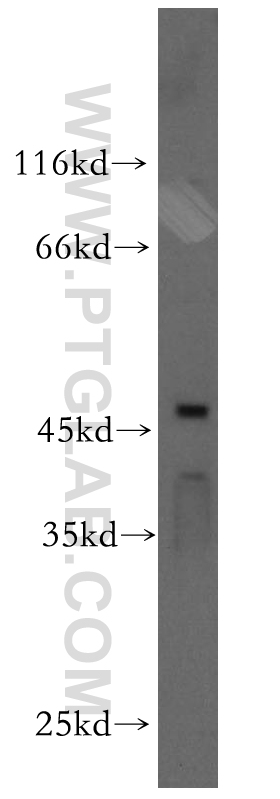 WB analysis of HeLa using 18998-1-AP