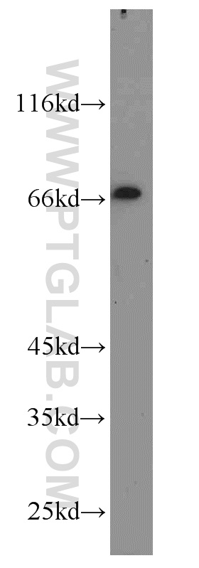 WB analysis of SH-SY5Y using 18999-1-AP