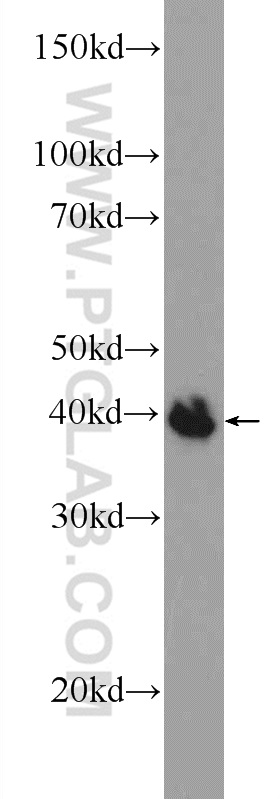 WB analysis of fetal human brain using 25114-1-AP