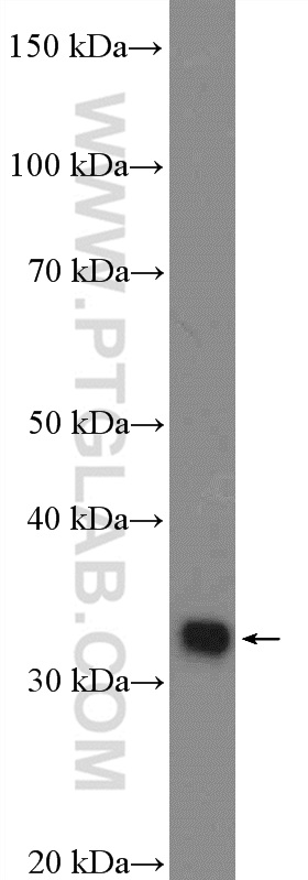 WB analysis of Neuro-2a using 21509-1-AP