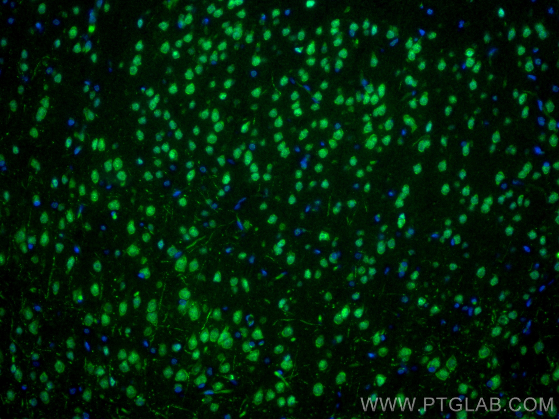 IF Staining of rat brain using 82980-1-RR