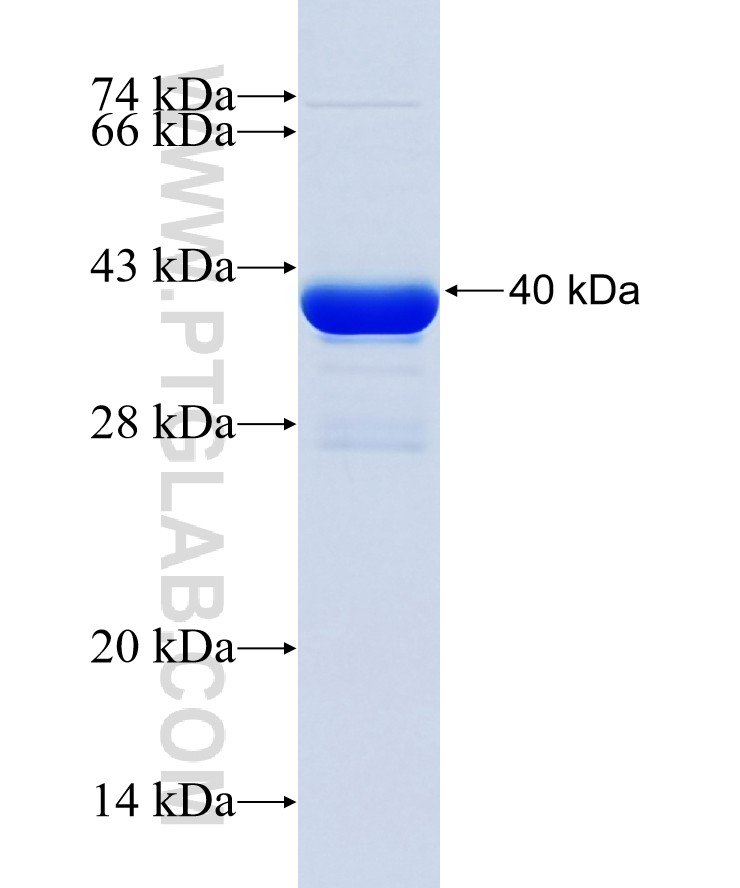 POU6F2 fusion protein Ag38018 SDS-PAGE