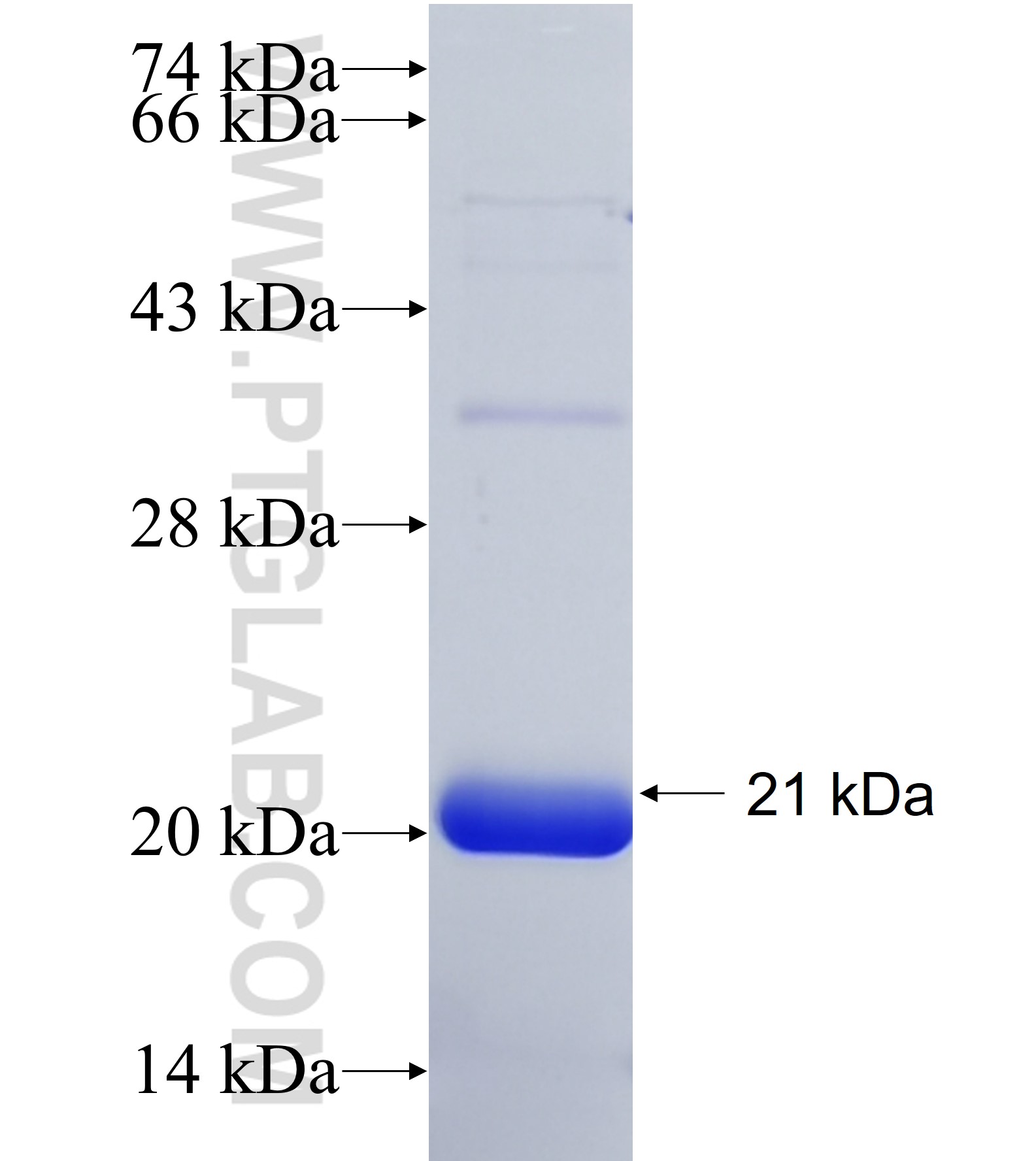 POU6F2 fusion protein Ag38031 SDS-PAGE