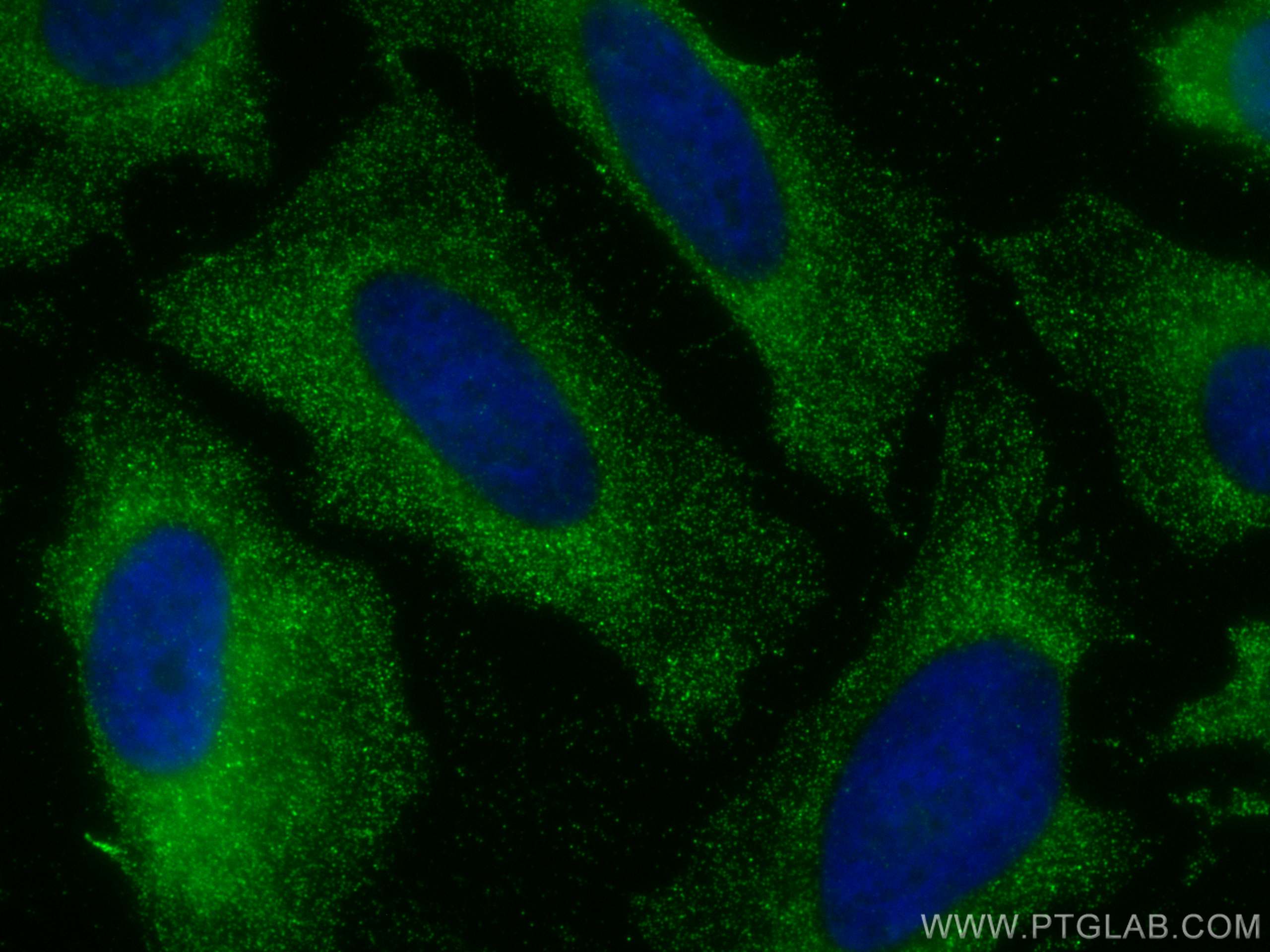 IF Staining of HeLa using 68178-1-Ig