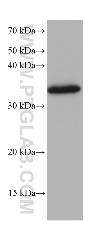 WB analysis of 4T1 using 68468-1-Ig