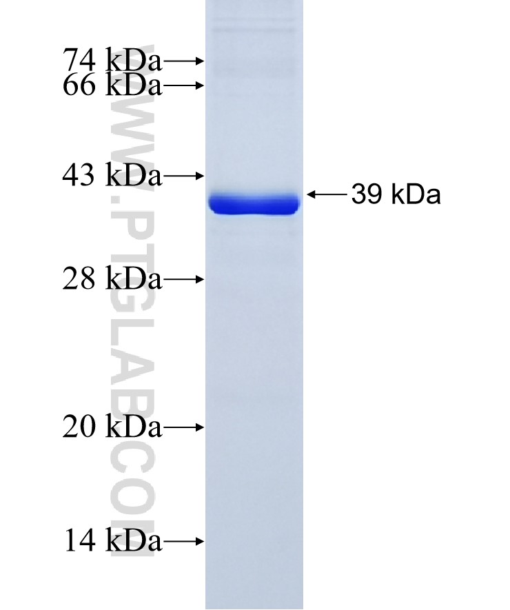 PPA2 fusion protein Ag10125 SDS-PAGE