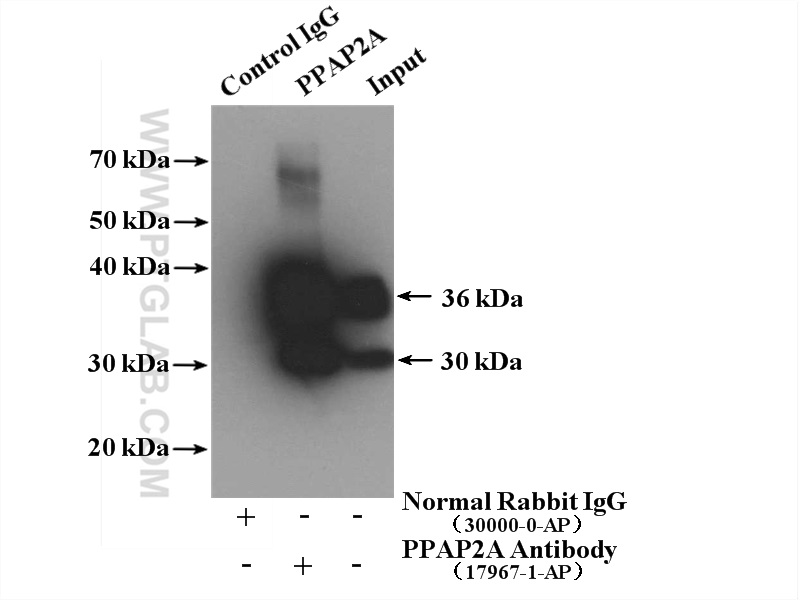 IP experiment of LNCaP using 17967-1-AP