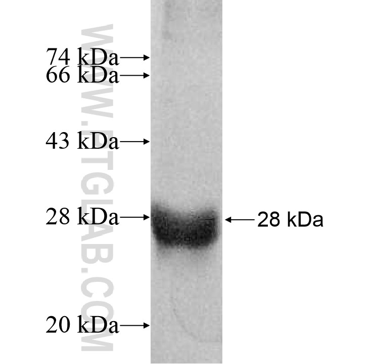 PPAP2A fusion protein Ag11615 SDS-PAGE