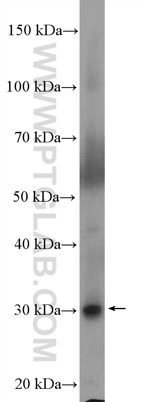 WB analysis of mouse liver using 10451-1-AP