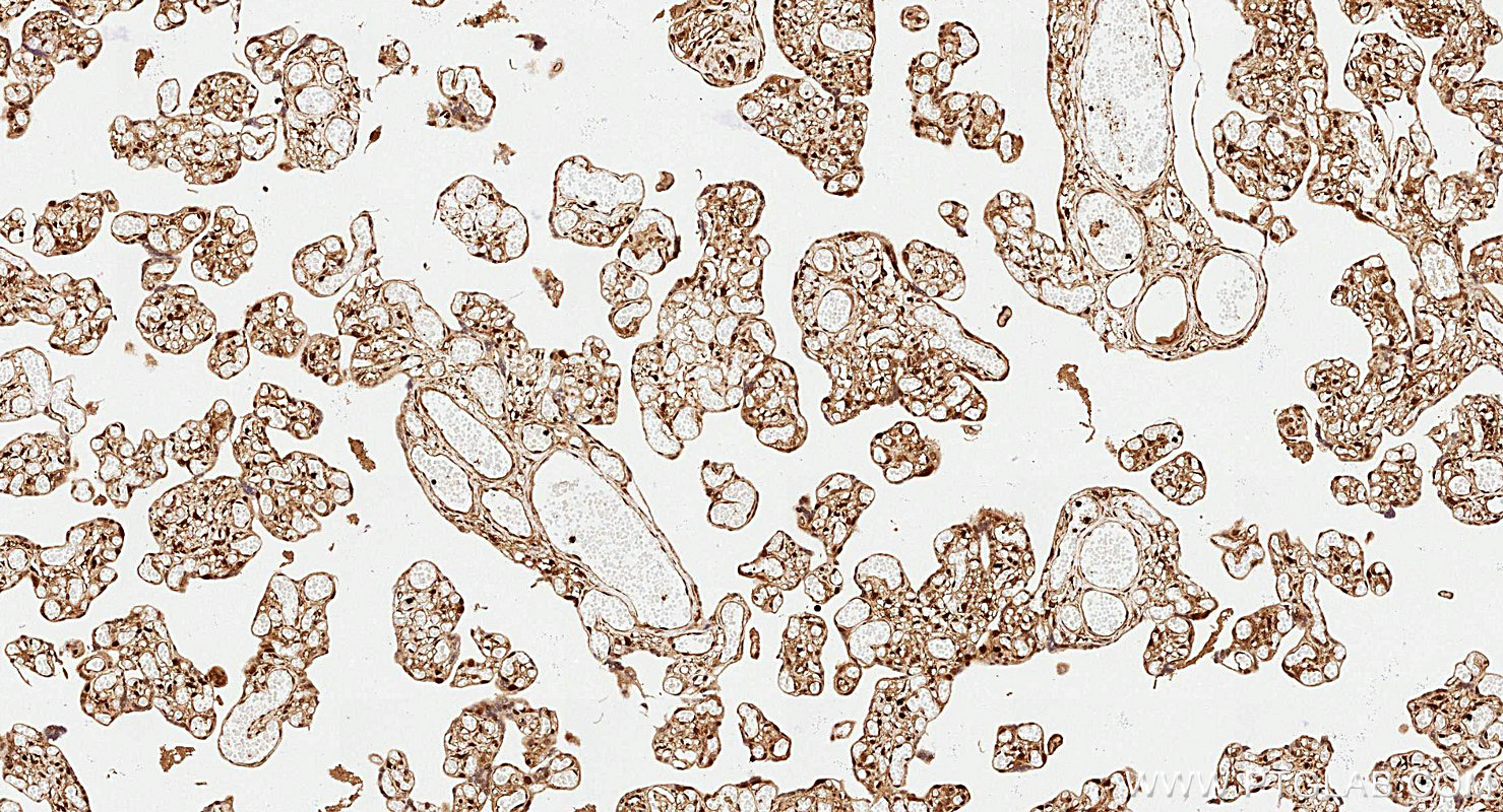 IHC staining of human placenta using 81490-5-RR