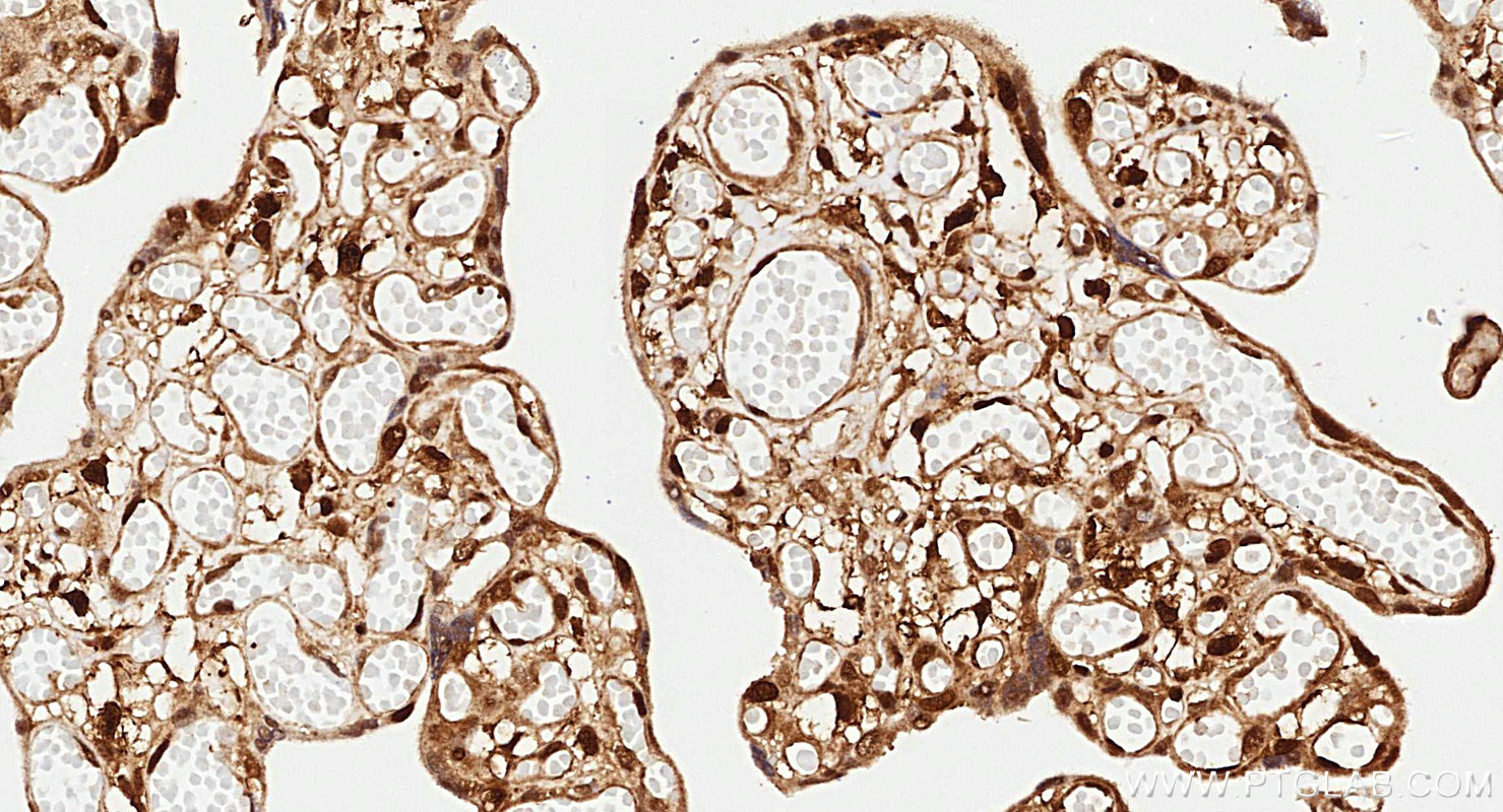 IHC staining of human placenta using 81490-5-RR