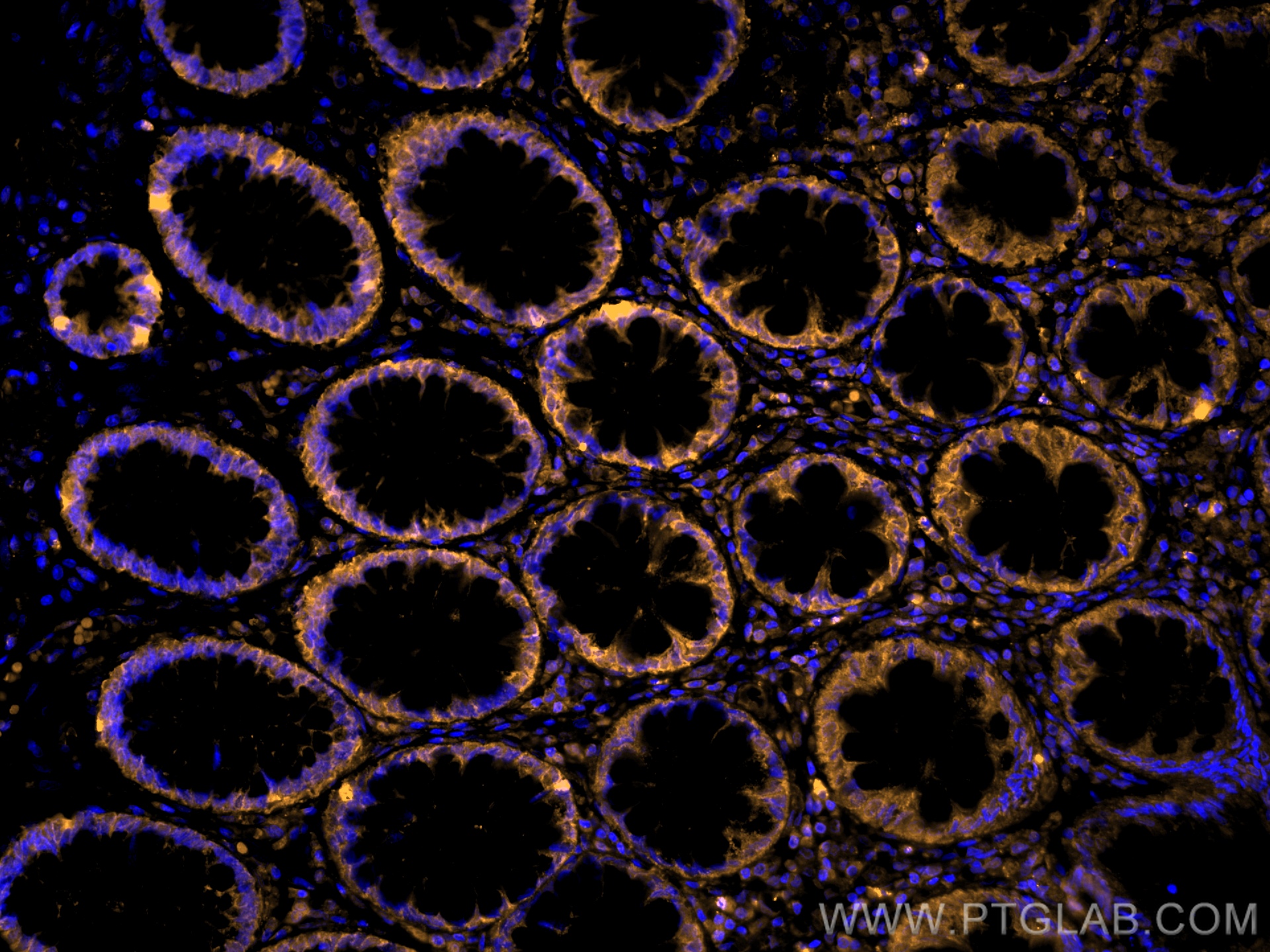 IF Staining of human colon using CL555-60127