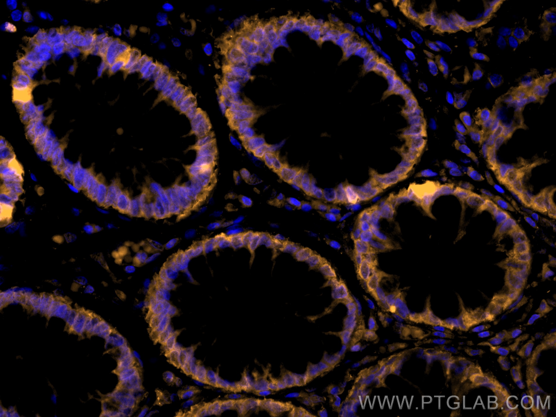 IF Staining of human colon using CL555-60127