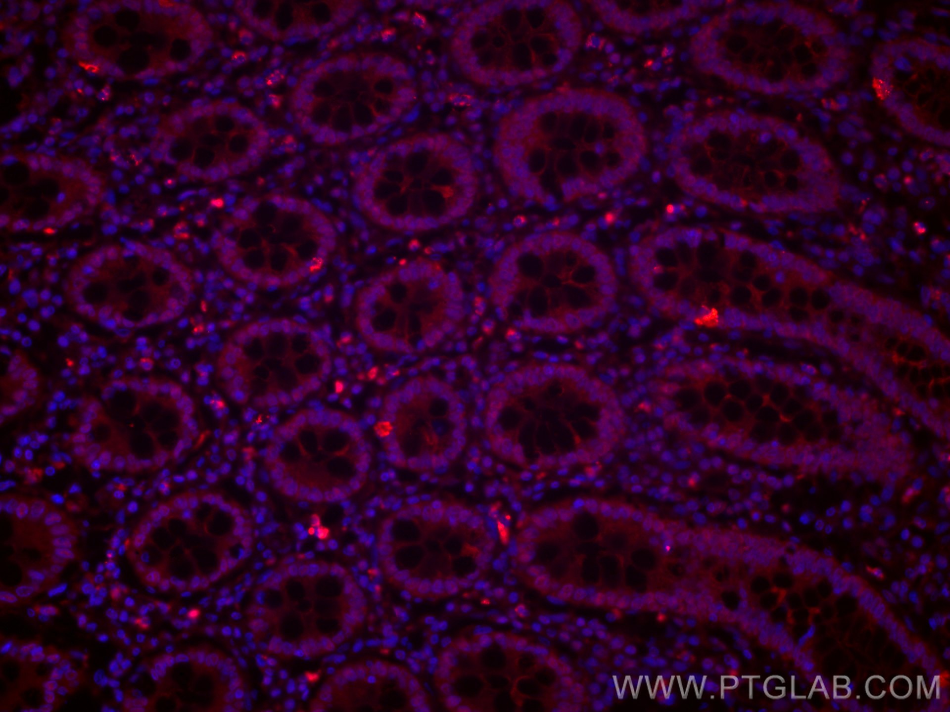 IF Staining of human colon using CL594-60127