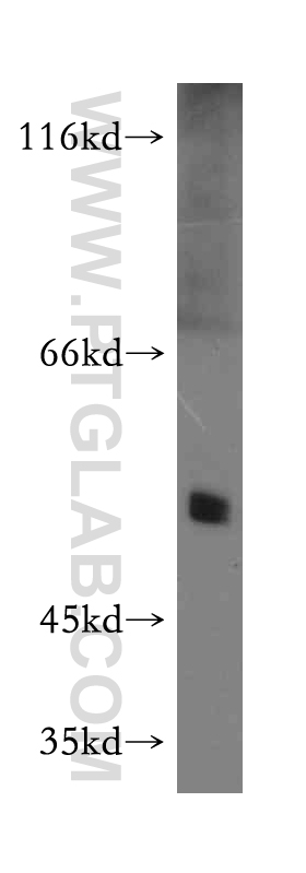 WB analysis of mouse heart using 10156-2-AP