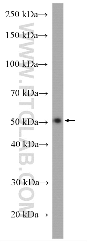 WB analysis of human placenta using 28053-1-AP