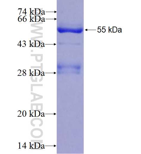 PPARD fusion protein Ag0208 SDS-PAGE