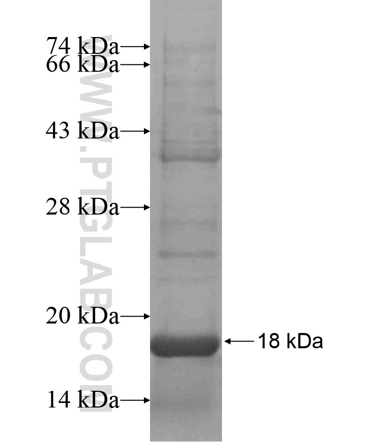 PPARD fusion protein Ag17467 SDS-PAGE PPARD fusion protein Ag17467 SDS-PAGE