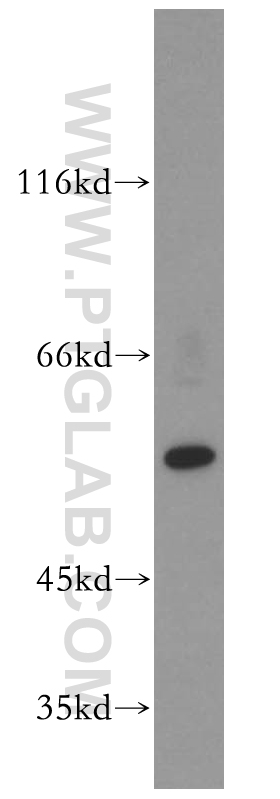 PPAR Gamma Polyclonal antibody