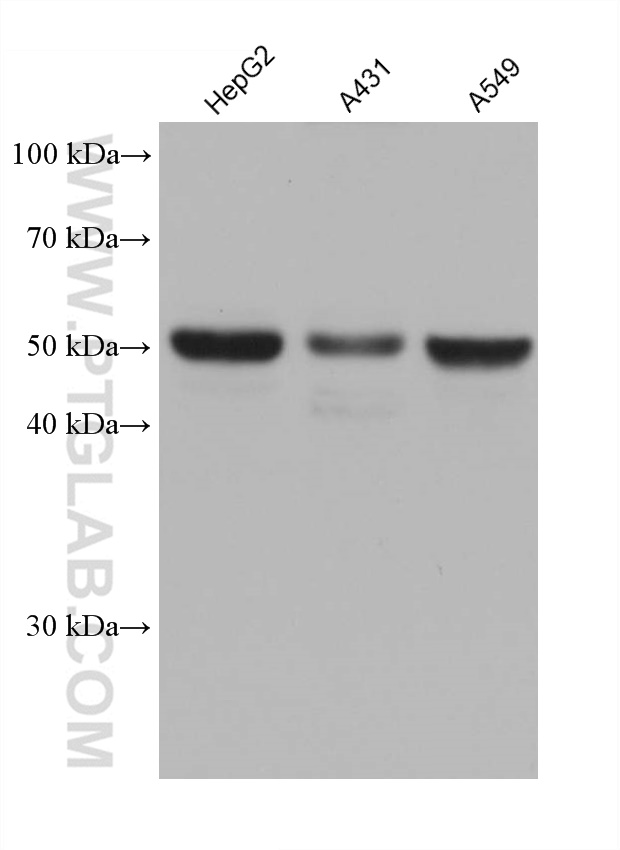 WB analysis using 66936-1-Ig