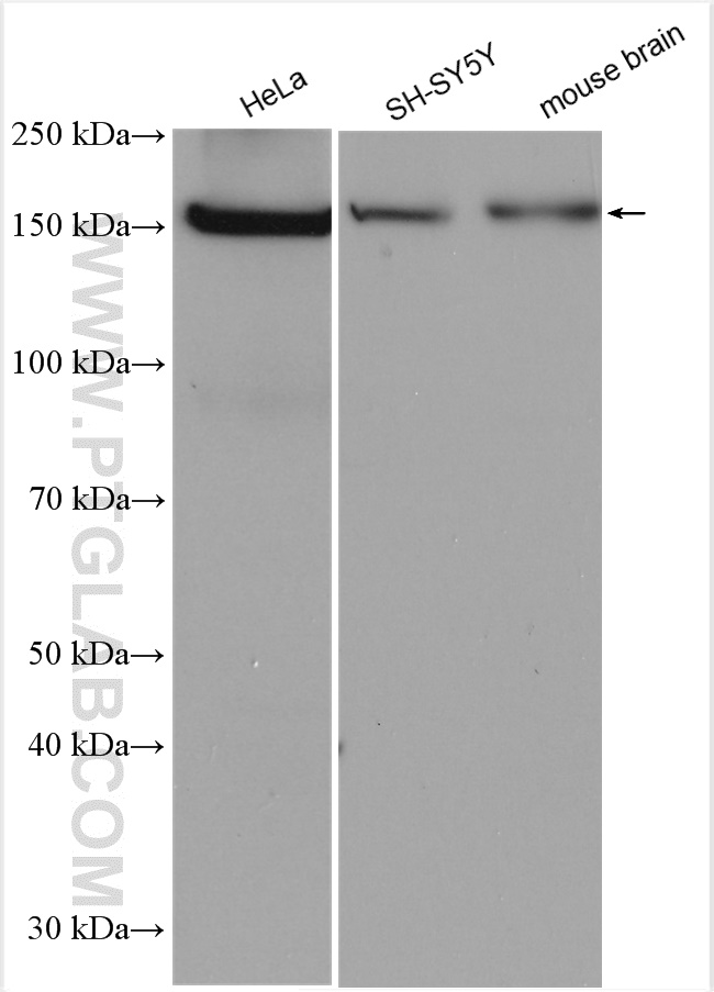 WB analysis using 67821-1-Ig