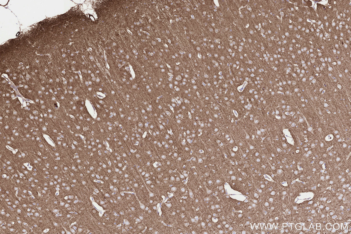 IHC staining of rat brain using 85096-1-RR IHC staining of rat brain using 85096-1-RR