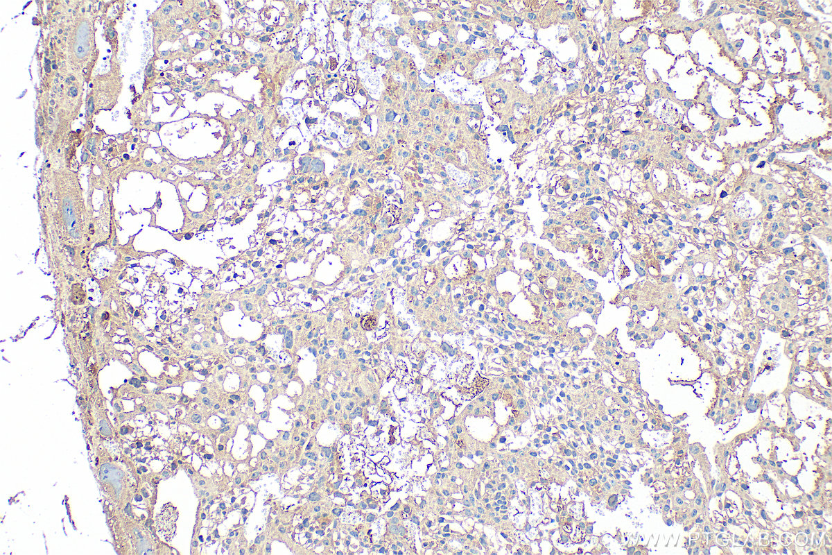 Immunohistochemical analysis of paraffin-embedded mouse placenta tissue slide using 13313-1-AP (CXCL7/PPBP antibody) at dilution of 1:200 (under 10x lens). Heat mediated antigen retrieval with Tris-EDTA buffer (pH 9.0). IHC staining of mouse placenta using 13313-1-AP