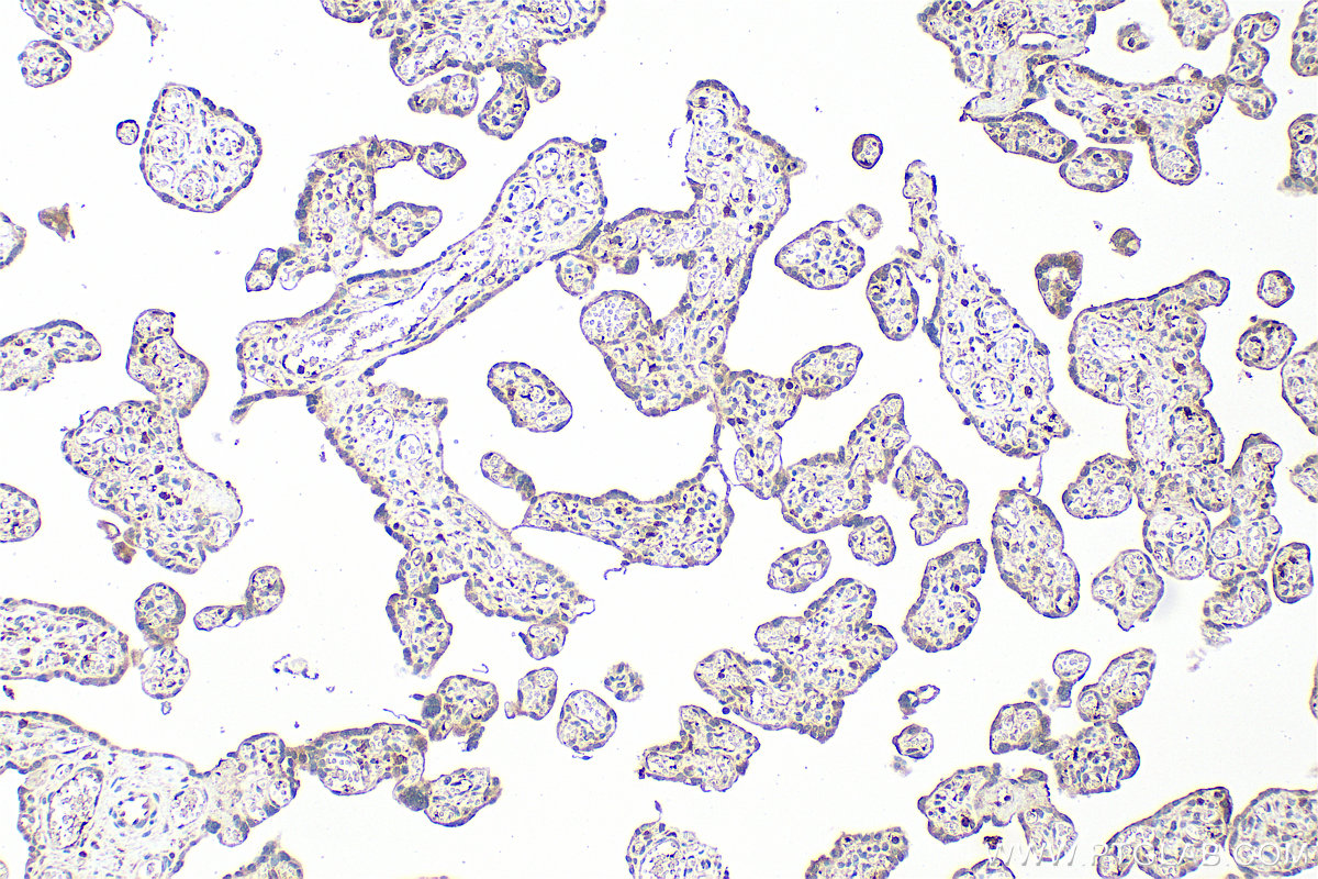 Immunohistochemical analysis of paraffin-embedded human placenta tissue slide using 13313-1-AP (CXCL7/PPBP antibody) at dilution of 1:200 (under 10x lens). Heat mediated antigen retrieval with Tris-EDTA buffer (pH 9.0). IHC staining of human placenta using 13313-1-AP