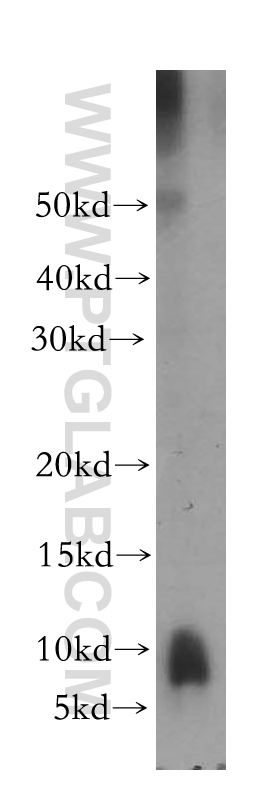 WB analysis of mouse liver using 13313-1-AP