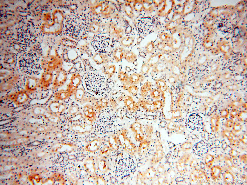 IHC staining of human kidney using 18001-1-AP (same clone as 18001-1-PBS)