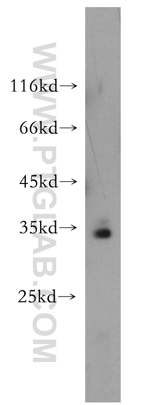 WB analysis of HeLa using 18001-1-AP (same clone as 18001-1-PBS)