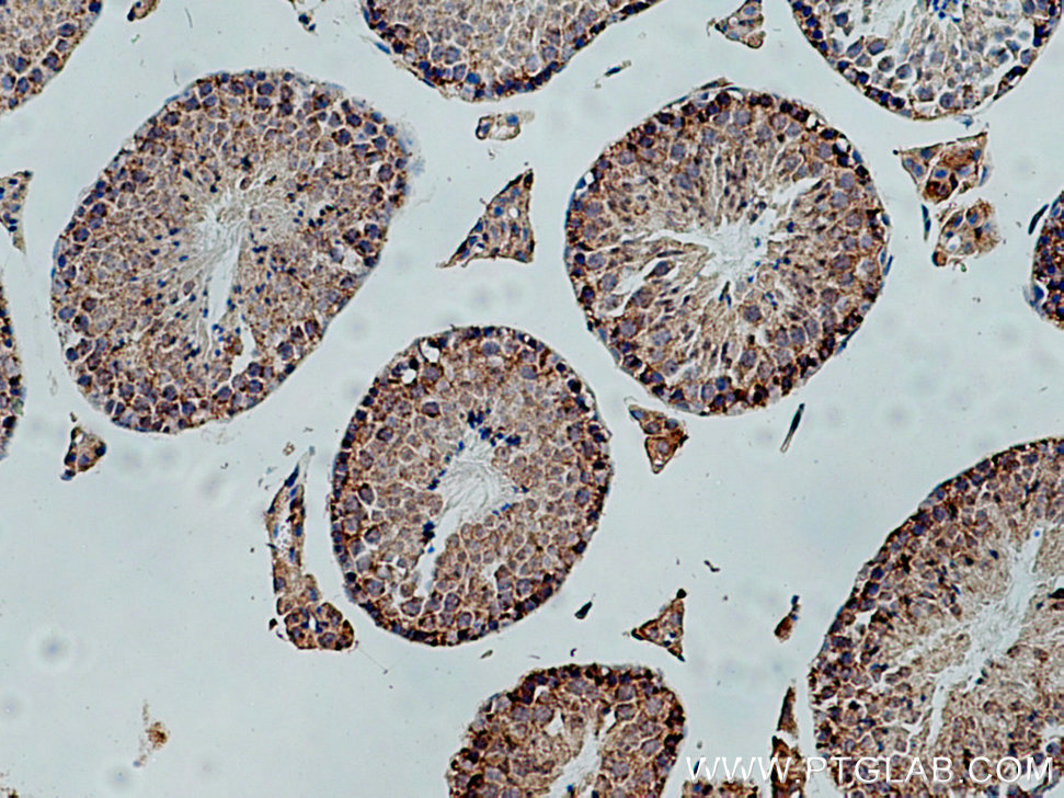 IHC staining of mouse testis using 12875-1-AP (same clone as 12875-1-PBS)